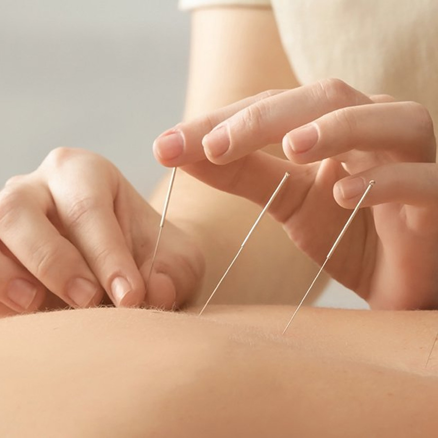 Стручна електроакупунктура за ефикасно намалување болка.